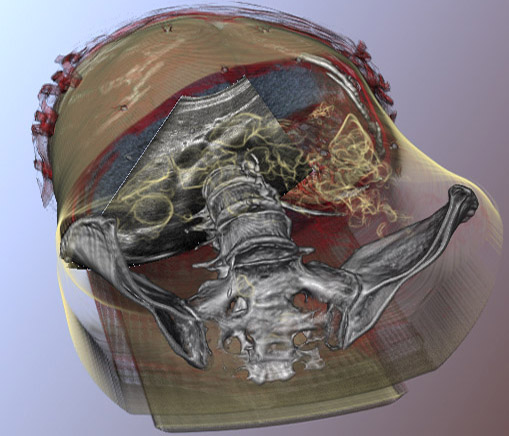 Illustrative Medical Visualisation