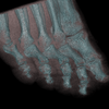 foot2_thumb.png