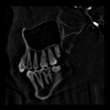 skull2_thumb.png