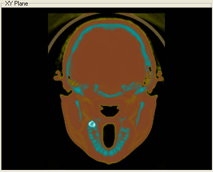 slice with applied transfer function