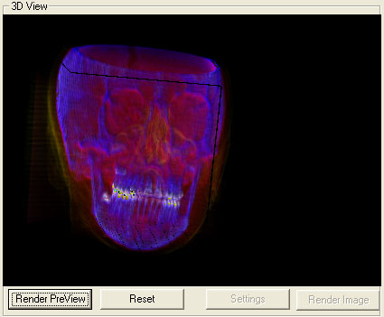 volume rendered human head