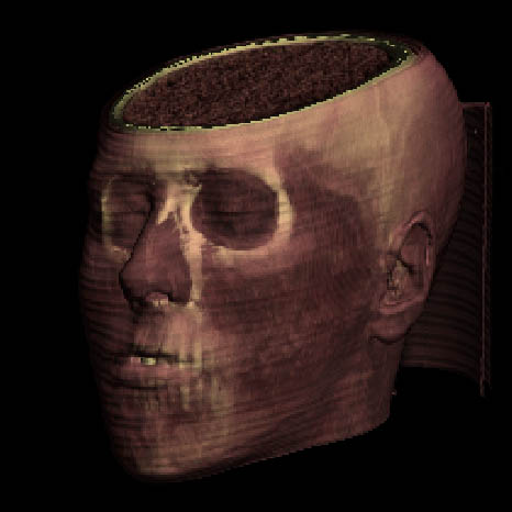 Levoy, Trilineare Interpolation, Phong-Schattierung