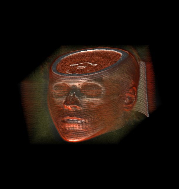 head.png