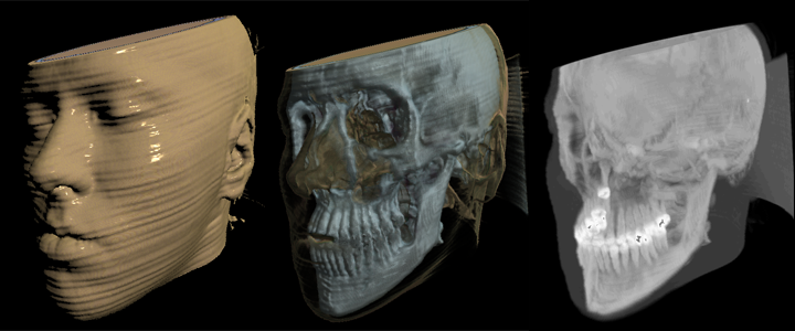 raycasting modes