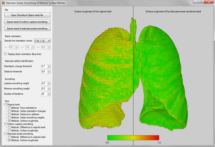 Staircase-Aware Smoothing of Medical Surface Meshes