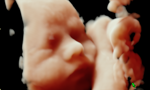 ICG Image 1