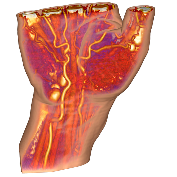 image: Context-Preserving Volume Rendering of a human hand