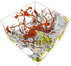 Computed tomography angiography of the human head visualized by the use of a semantic transfer function model.