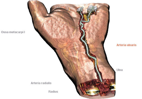 image2: hand - arteria ulnaris