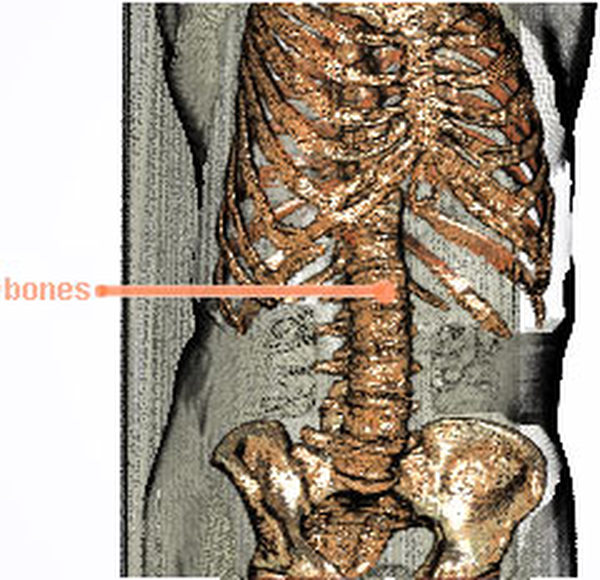 image5: torso - bones