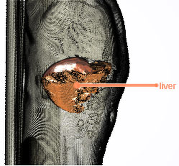 image8: torso - liver