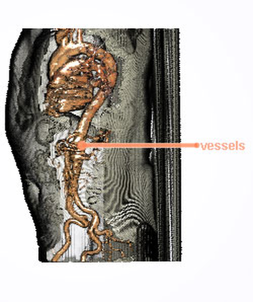 image9: torso - vessels