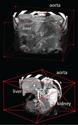 Image1: A polyhedron for volume of intereste selction.