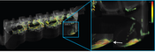 Figure3: A feature based focus+context visualizaion showing regions of near stagnant, hot flow with medium to high levels of the lambda2 vortex detector