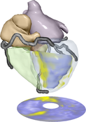 image: 3D model of the heart annotated with viability data