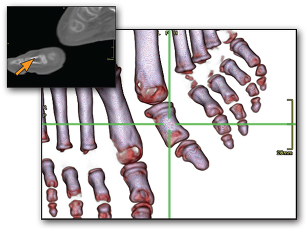 Image: Automatic 3D view selection