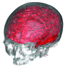 Multimodal Visualization of CT and MRI