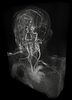 Maximum Intensity Difference Accumulation (MIDA) of an MRI angiography data set