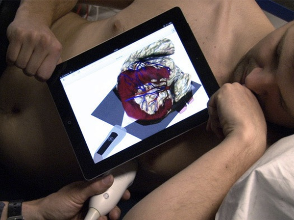 Teaser: Real-time visual guidance for ultrasound examinations on an iPad