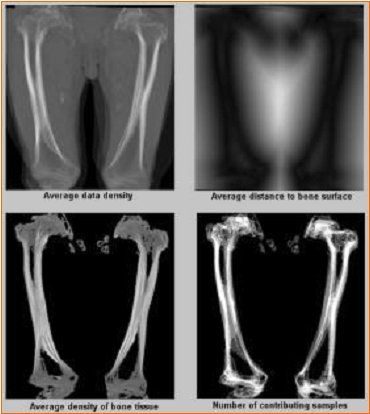 Bone Segmentation in CT-Angiography Data Using a Probabilistic Atlas | TU  Wien – Research Unit of Computer Graphics