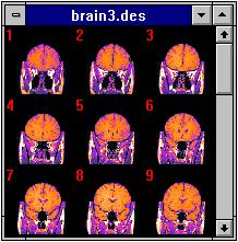 Multi-Image Example
