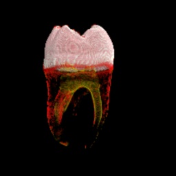 Tooth by 0.7 %