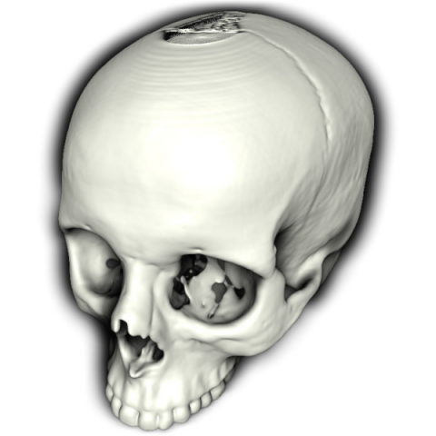 rendered skull