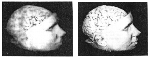 Comparison normal and gaze-directed volume rendering